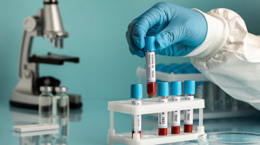 Qué análisis de sangre conviene hacerse después de los 40 para cuidar la salud