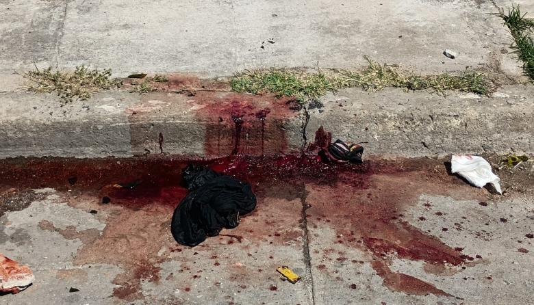 BERISSO | Una pelea con botellas rotas dejó gravemente herido a un hombre