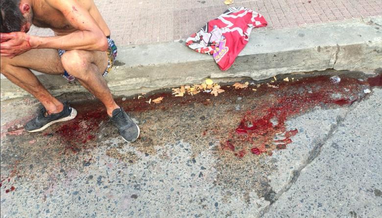 Riña, sangre y detenciones frente al Bingo de La Plata: carnearon a un trapito