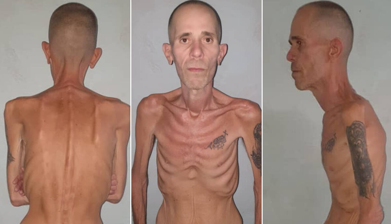 Cuba: liberan a preso político en estado extremo y denuncian torturas