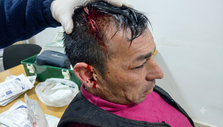 Batalla campal en el Hipódromo de La Plata: le destrozaron la cabeza a un sindicalista