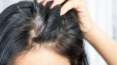 ¿Por qué tengo canas si soy joven? Lo que nadie te cuenta