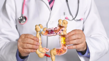 Cáncer de colon en Argentina: cifras, riesgo y factores hereditarios