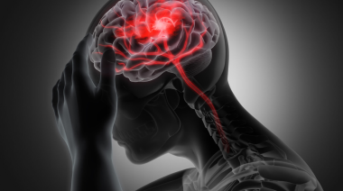 Cuatro señales metabólicas que alertan sobre el riesgo de accidente cerebrovascular