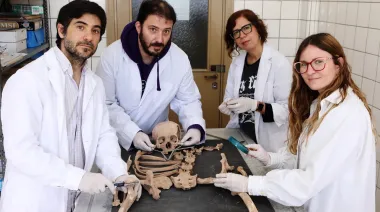 La UNLP revela un hallazgo impactante: más del 80% de los esqueletos analizados padecía artrosis