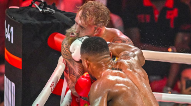 Jake Paul sufrió una doble fractura de mandíbula tras la pelea con Anthony Joshua y fue operado en Miami