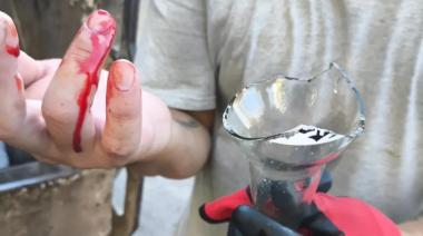 Un corte que pudo evitarse: El STMB reclama mayor responsabilidad ciudadana tras el accidente de un recolector