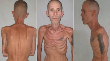 Cuba: liberan a preso político en estado extremo y denuncian torturas