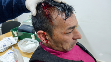 Batalla campal en el Hipódromo de La Plata: le destrozaron la cabeza a un sindicalista