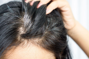 ¿Por qué tengo canas si soy joven? Lo que nadie te cuenta