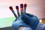 Fabricar sangre en laboratorio: un paso clave para todos
