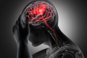 Cuatro señales metabólicas que alertan sobre el riesgo de accidente cerebrovascular