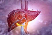 Diabetes tipo 2 y hígado graso: cómo detectarlo y prevenir complicaciones