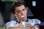 Racing: Santiago Sosa sufrió una fractura por un codazo de Marcos Rojo y deberá ser operado