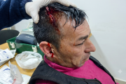 Batalla campal en el Hipódromo de La Plata: le destrozaron la cabeza a un sindicalista
